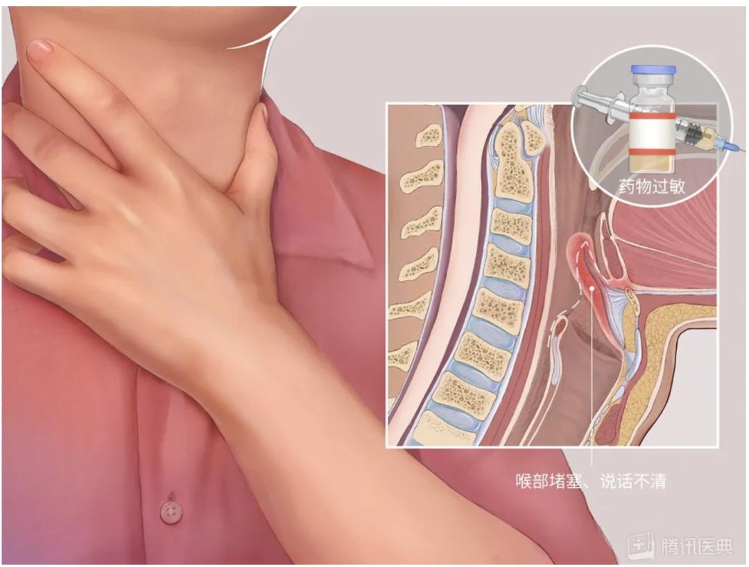 阳后喉咙痛会持续多久,半夜喉咙干疼要警惕四种疾病