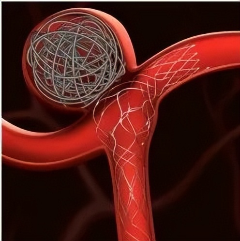 医疗技术突破拯救癌症晚期病人,医学方面新技术救人
