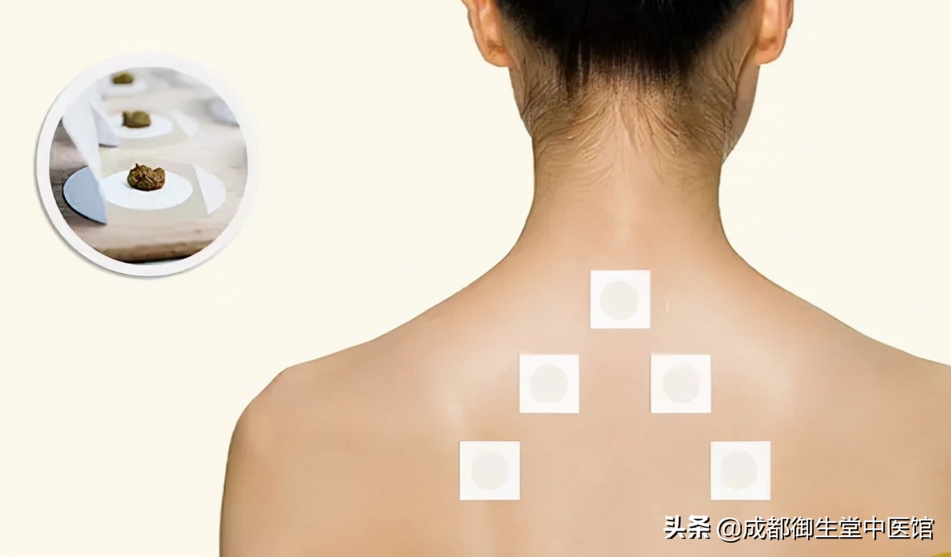 妇科疾病，用中医如何护理