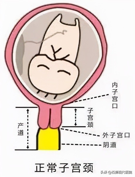 反复流产小心黄体功能不全,反复流产不要忽视男性因素