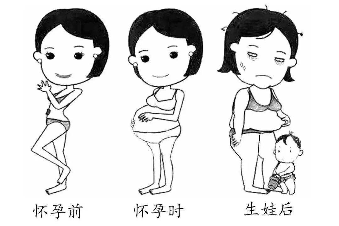 誉儿阁产后调理中心：产后肉松肚子大怎么办？腹直肌分离六问六答