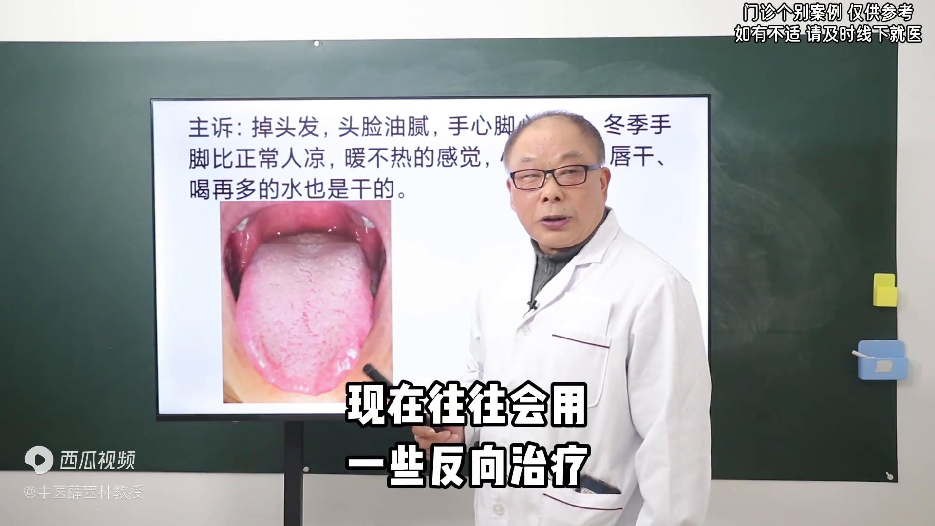 头脸出油严重吃什么,头脸身体出油