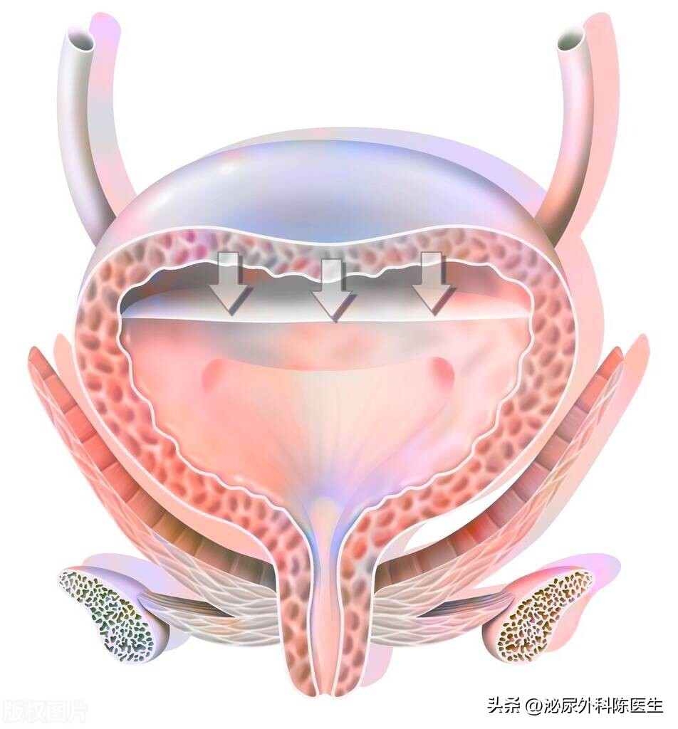 尿道口老是有残余尿,女性为什么有残余尿