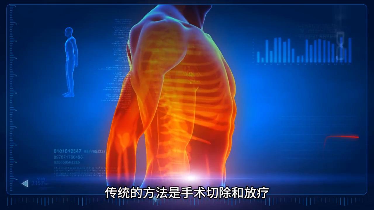 介入和消融治疗肝癌的优点和缺点,纳米消融技术治肝癌在什么医院有