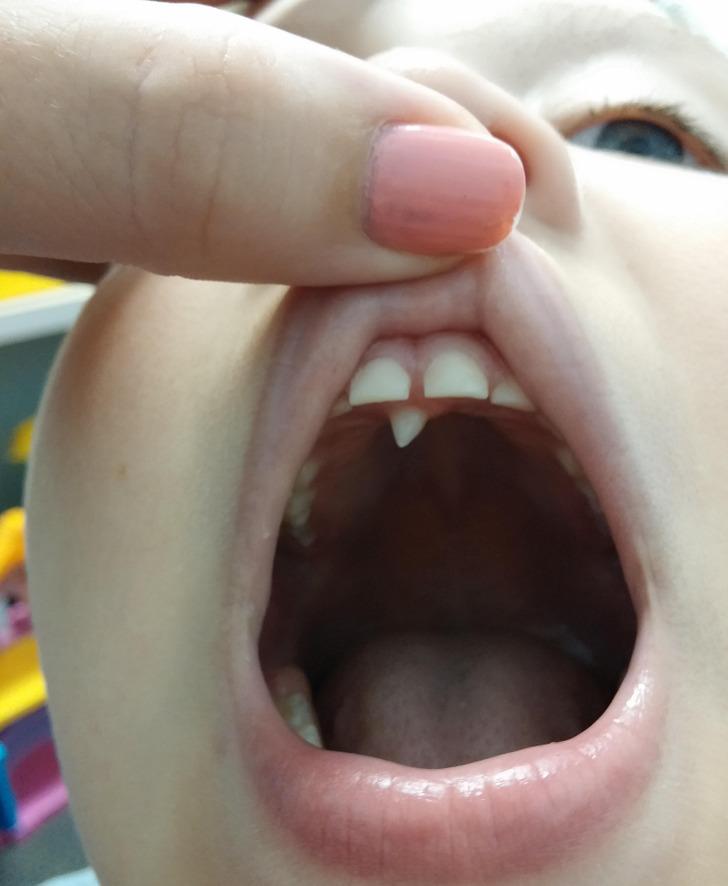 舔狗自述：阿珍和她丈夫去妇幼保健院了，我是不是应该死心了？