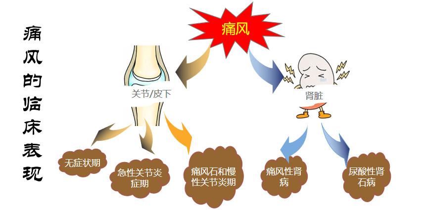 王宝强痛风吃什么药,王宝强痛风发作是什么节目