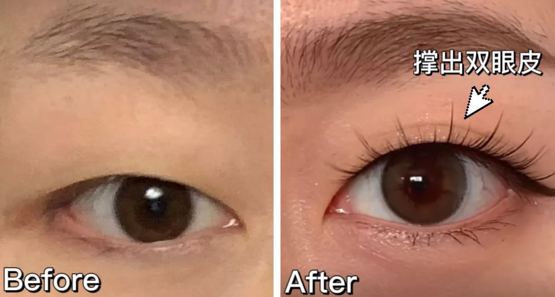 小眼睛怎么戴口罩好看,戴口罩颜值增加办法