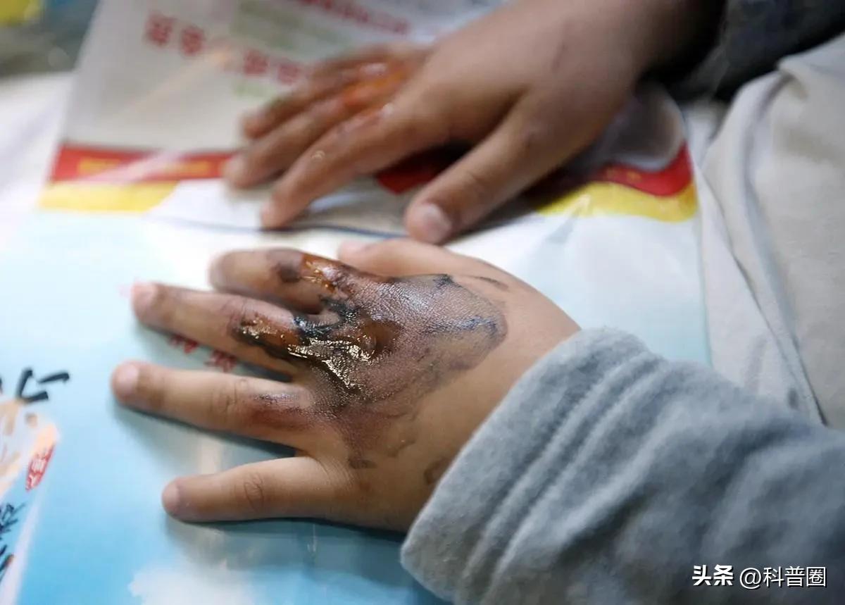 小孩玩具氢气球爆炸,儿童氢气球危险视频