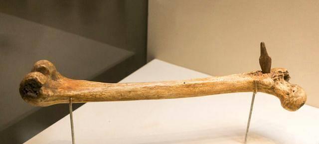 医术绝伦！这几位拯救箭伤的神医厉害到爆！