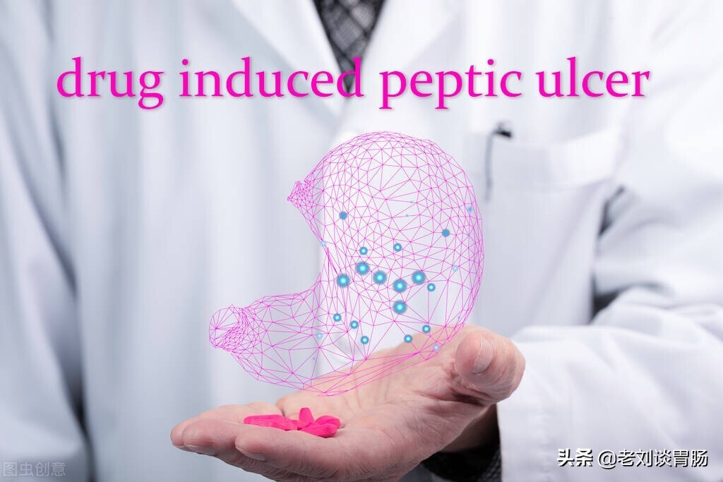 替普瑞酮是保护胃黏膜的药物吗,胃黏膜保护药有哪些