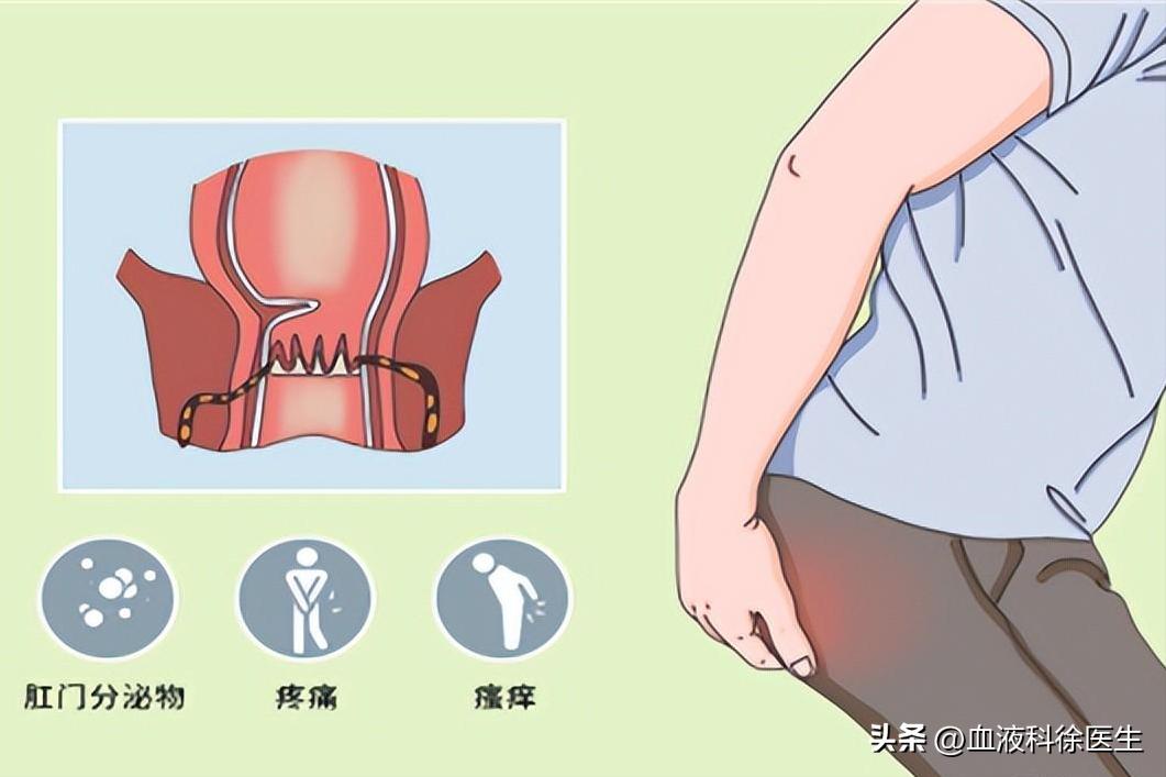 肛瘘手术真的有那么痛苦嘛,肛瘘手术在所有手术中的痛苦排名