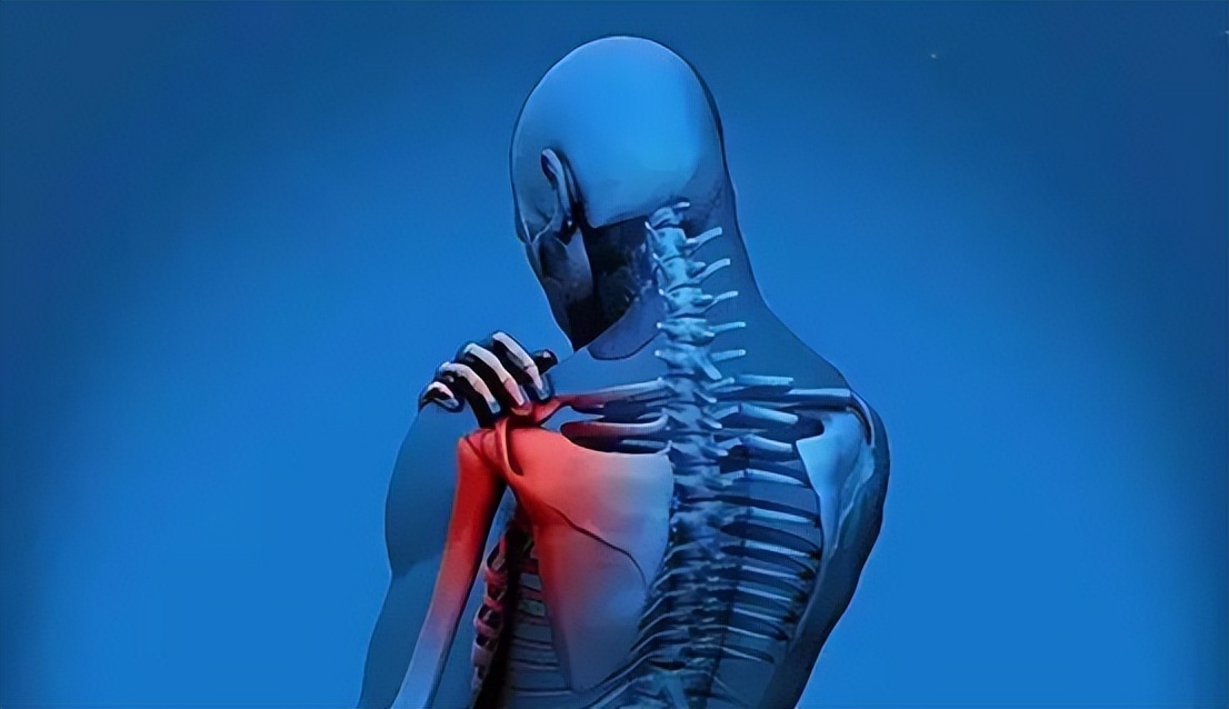 经常背痛是不是肩周炎,老是肩膀酸痛是肩周炎吗