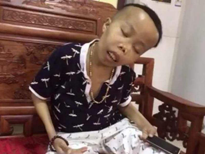 曾经的网红陈山现在的处境,陈山为什么成网红