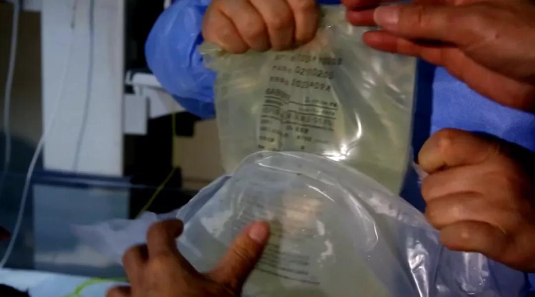 新生儿急性肾衰竭能治愈么,新生儿急性肾衰竭治好的几率