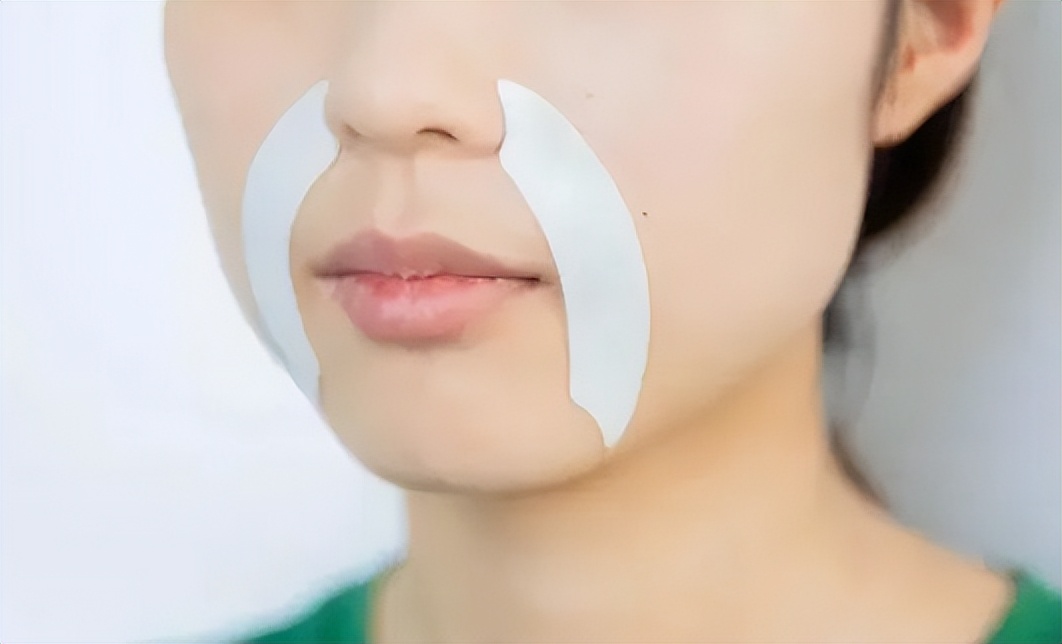 遗传的法令纹特别显老怎么办,眼睛泪沟和法令纹显老怎么办