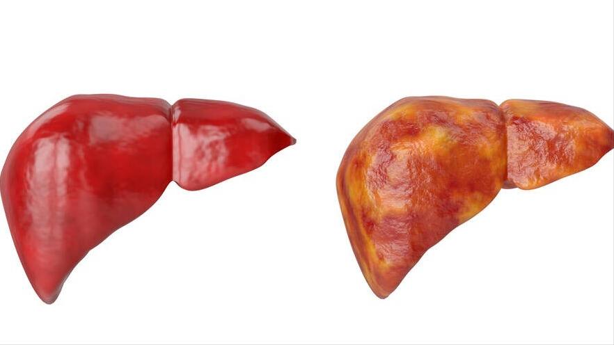 谷丙转氨酶高与谷草转氨酶高区别,谷丙转氨酶和谷草转氨酶怎么降低