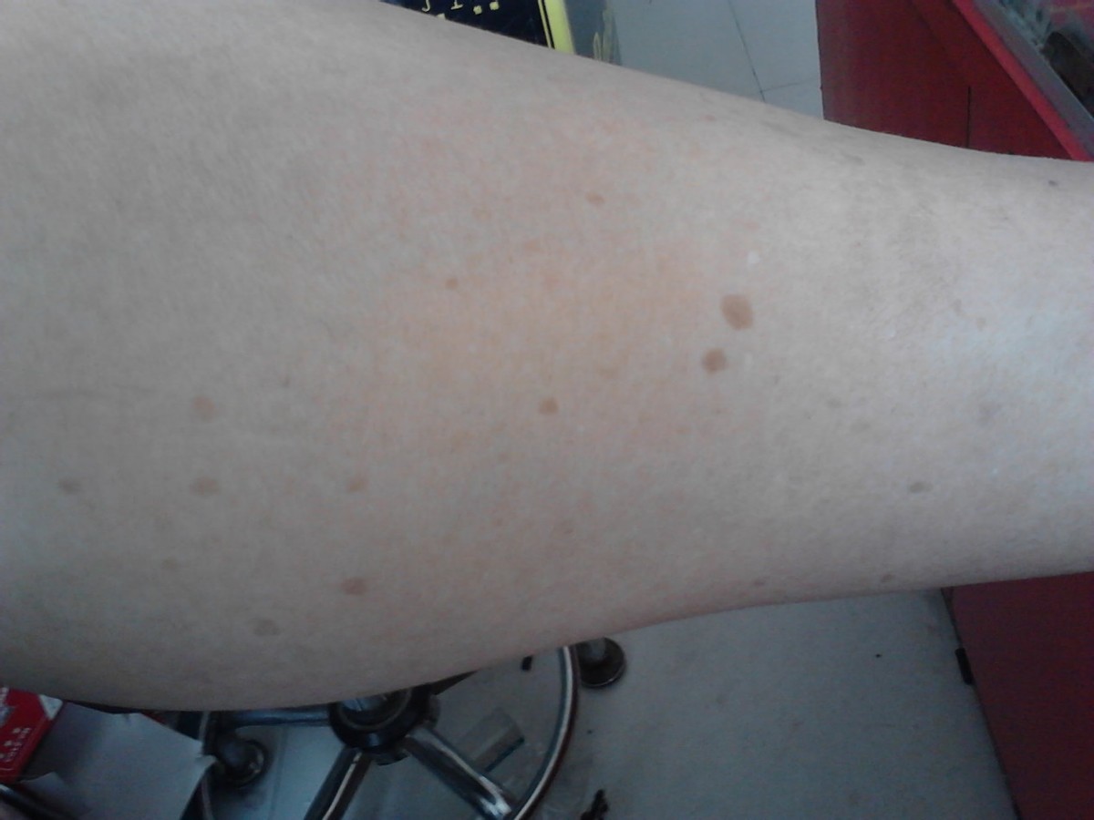 老年斑的克星牙膏怎么用,什么牙膏可以淡化老年斑