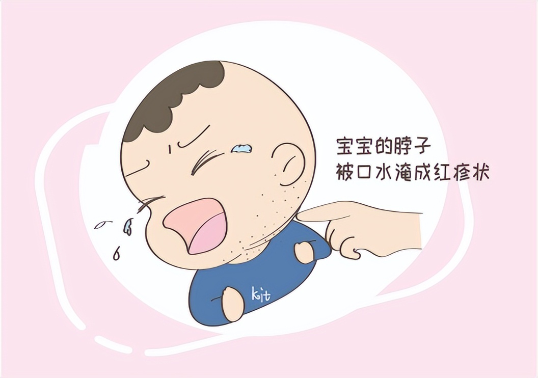 宝宝淹脖子怎么办啊,宝宝淹脖子怎么办可以用润肤油