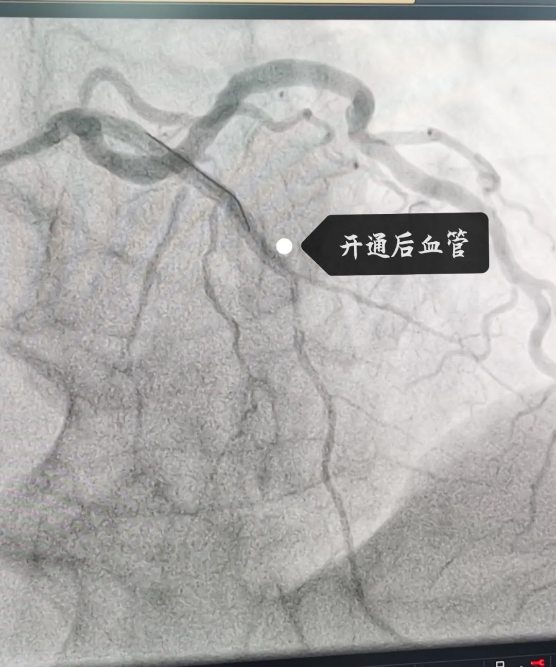南昌最好的医院心血管内科,南昌一附院心血管内科怎么样