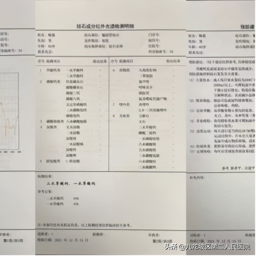 结石神器,结石碎石神器