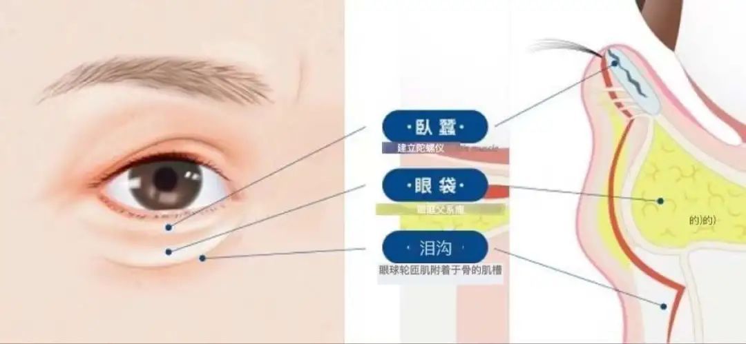 泪沟的克星是什么牌子,眼袋泪沟的克星