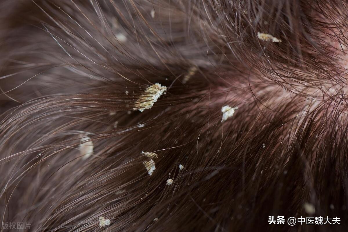 缺维生素b6会引起皮肤过敏吗,皮肤不好吃维生素b6还是吃b2