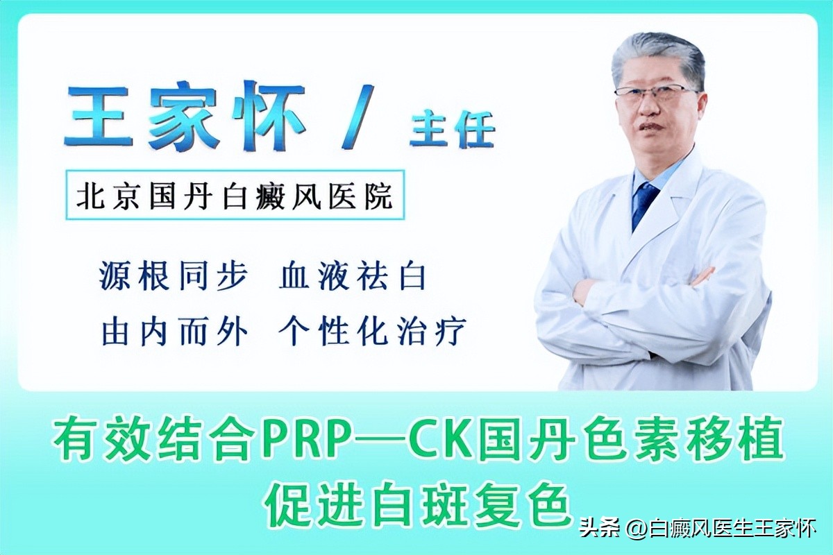 儿童局限性白癜风,怎样判断是局限性白癜风