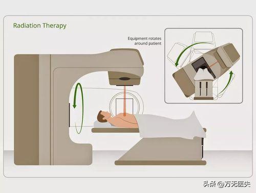 50岁女性患外阴癌,后悔不已!警示女性:出现下身不舒服,别忽略