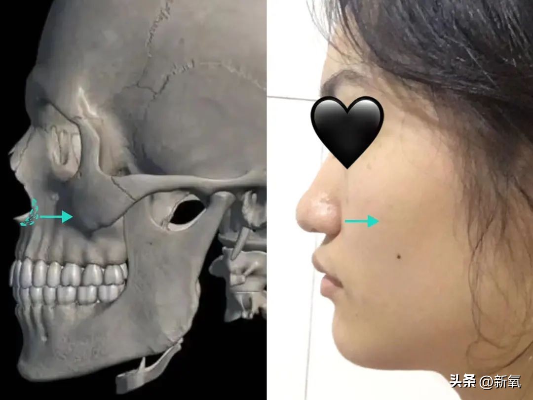改一点赢很大？她整完鼻子直接美成断代神颜…