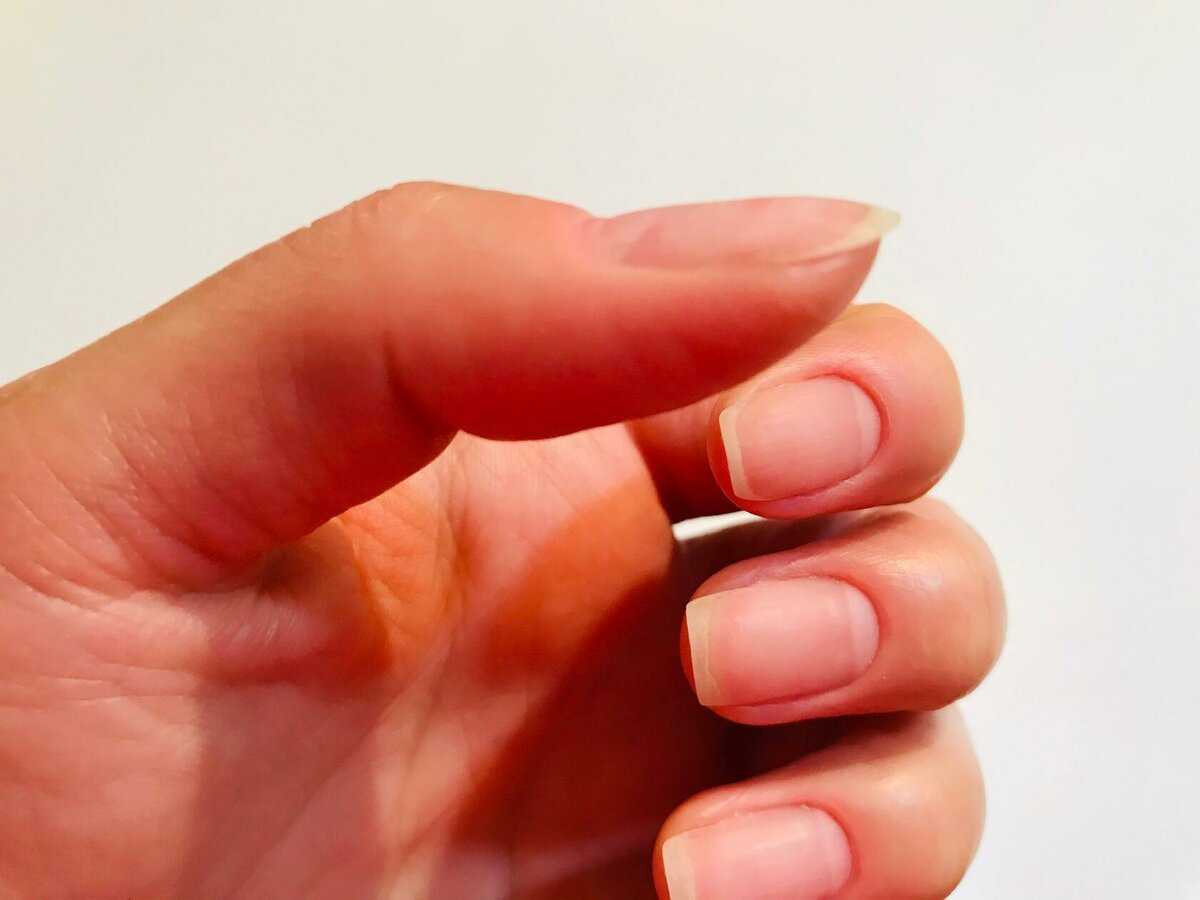 指甲有凹凸的波浪纹是什么原因,指甲渐变有条纹怎么解决