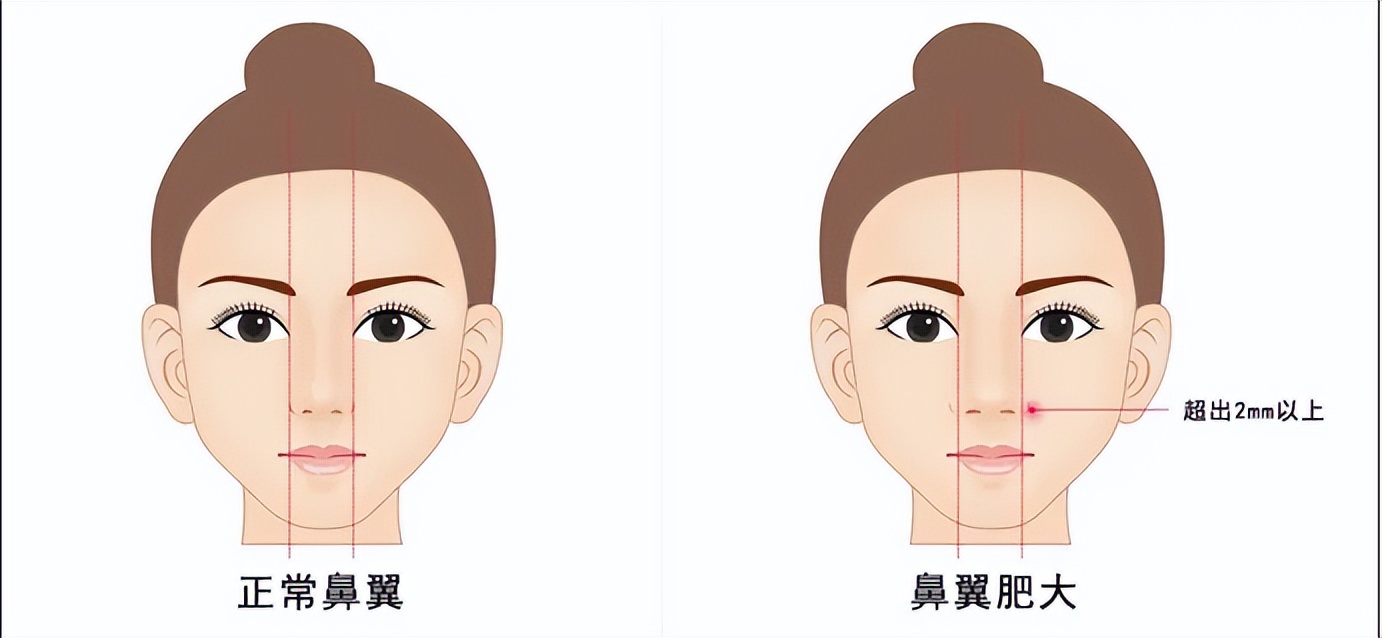 上海九院韦敏做的鼻子,上海九院韦敏和张盈帆隆鼻哪个好