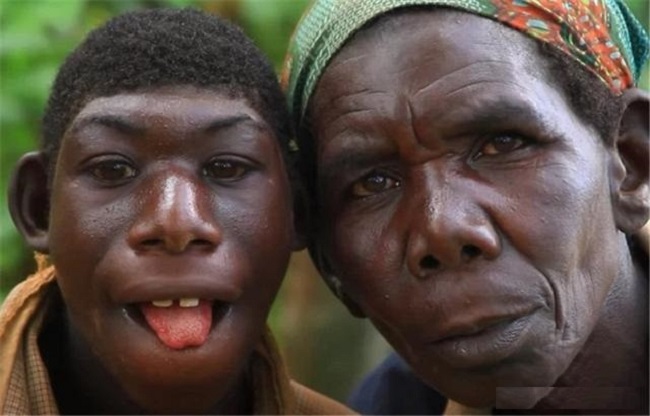 非洲23岁男孩酷似猿猴，不会说话只会叫，是何让他获取粉丝1000万