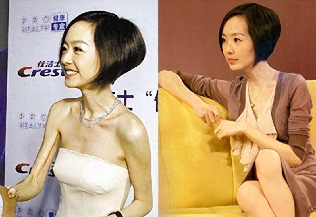 瘦到病态的审美,瘦到病态