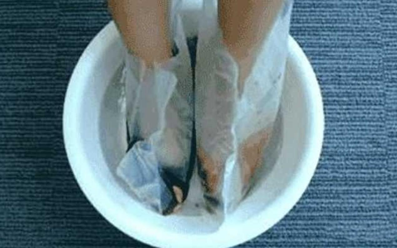 跖疣冷冻破了怎么办,跖疣反复冷冻不好怎么处理