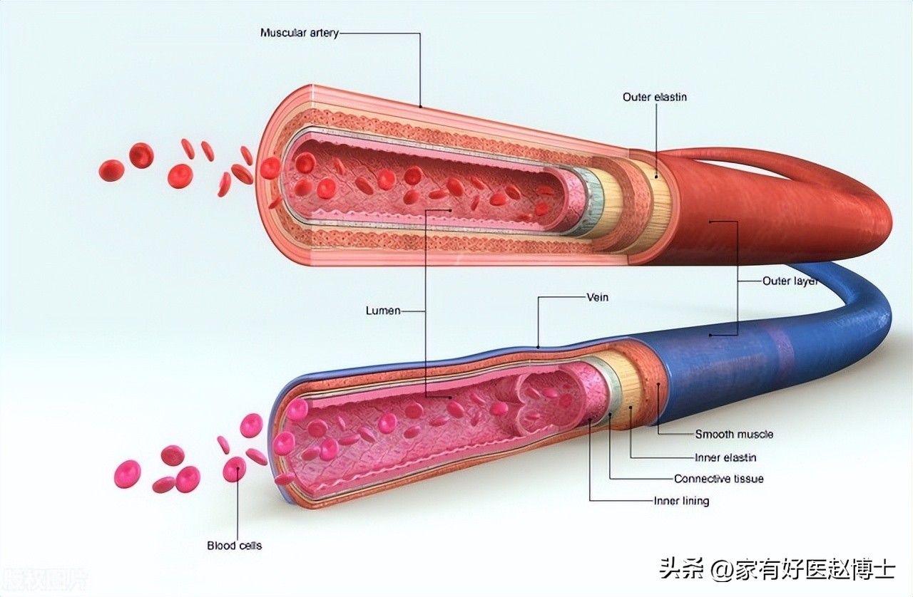 iwatch怎么预防心梗脑梗,张之瀛大夫如何预防心梗和脑梗