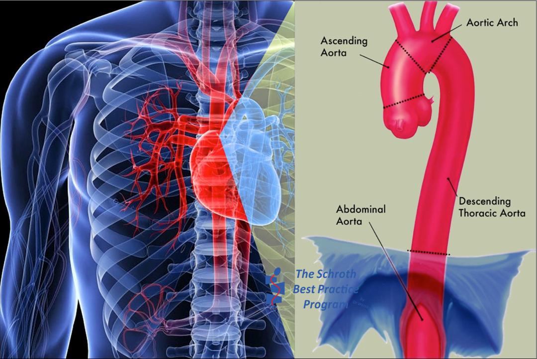 胸椎稍向右侧侧凸怎么矫正,儿童胸椎向右侧凸是什么意思