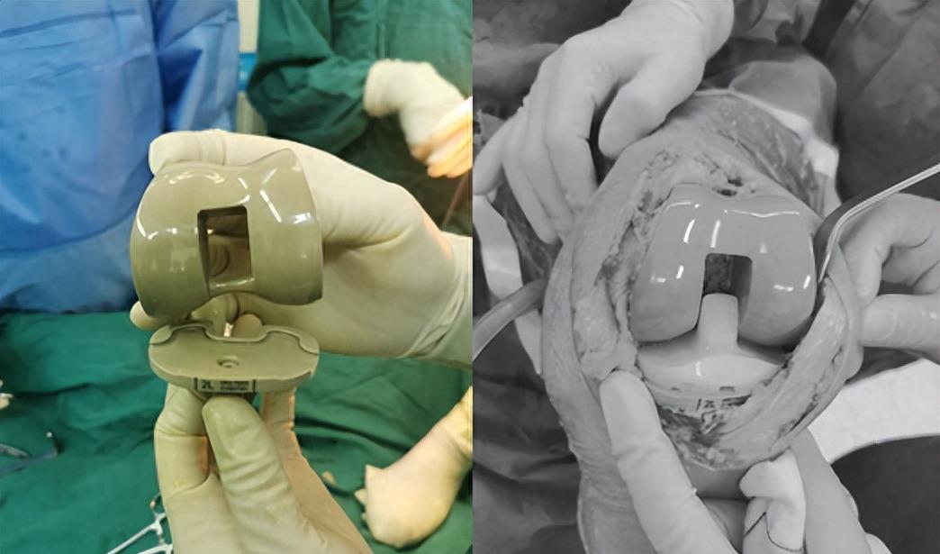 痛苦的手术排名,十大最痛苦的手术排名