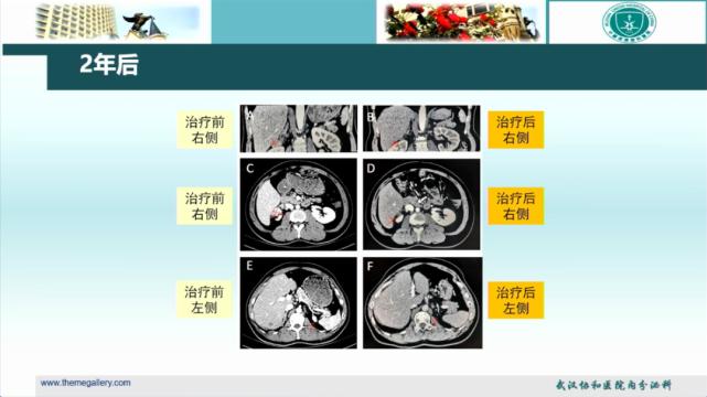 病例分享科普文章,最易误诊的经典病例分享