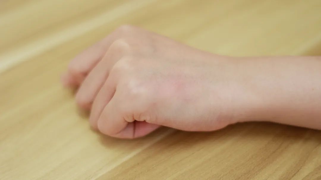 上嘴唇过敏性皮炎是什么症状,过敏性皮炎的症状及治疗方法