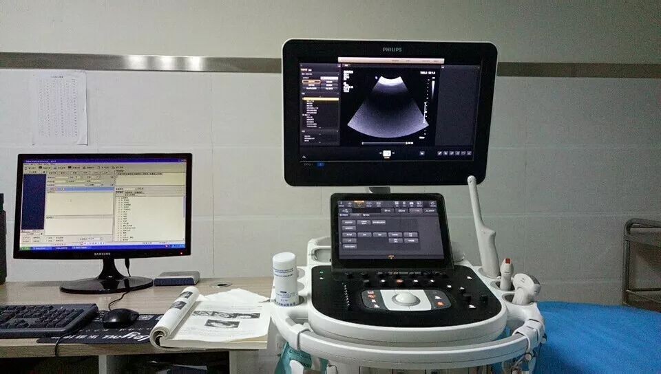 超声检查对身体的危害,科普超声检查对身体有害不