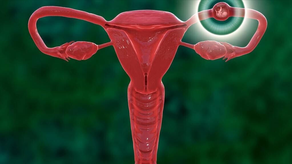 中医对输卵管积水囊肿治疗效果,输卵管积水引起的不孕治疗要慎重