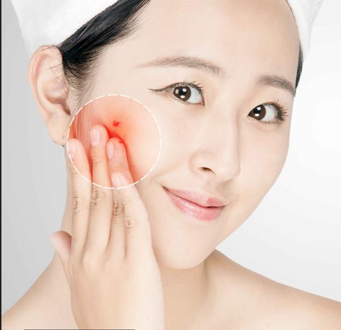 皮肤油腻易出油是身体哪出问题了,皮肤油腻易出油用什么护肤品