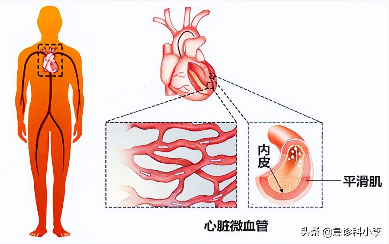 脑梗病人吃叶酸和b12b6起什么作用,叶酸配维生素b12预防脑梗怎样服用