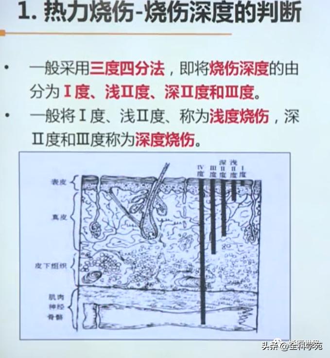 烧伤烫伤防护与急救知识英文,烧伤冻伤如何处理