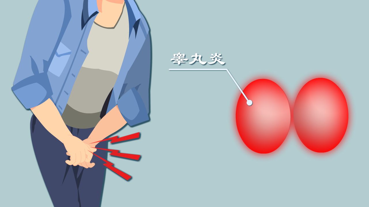 精子很稀得了无精症,精子稀如水是无精症吗