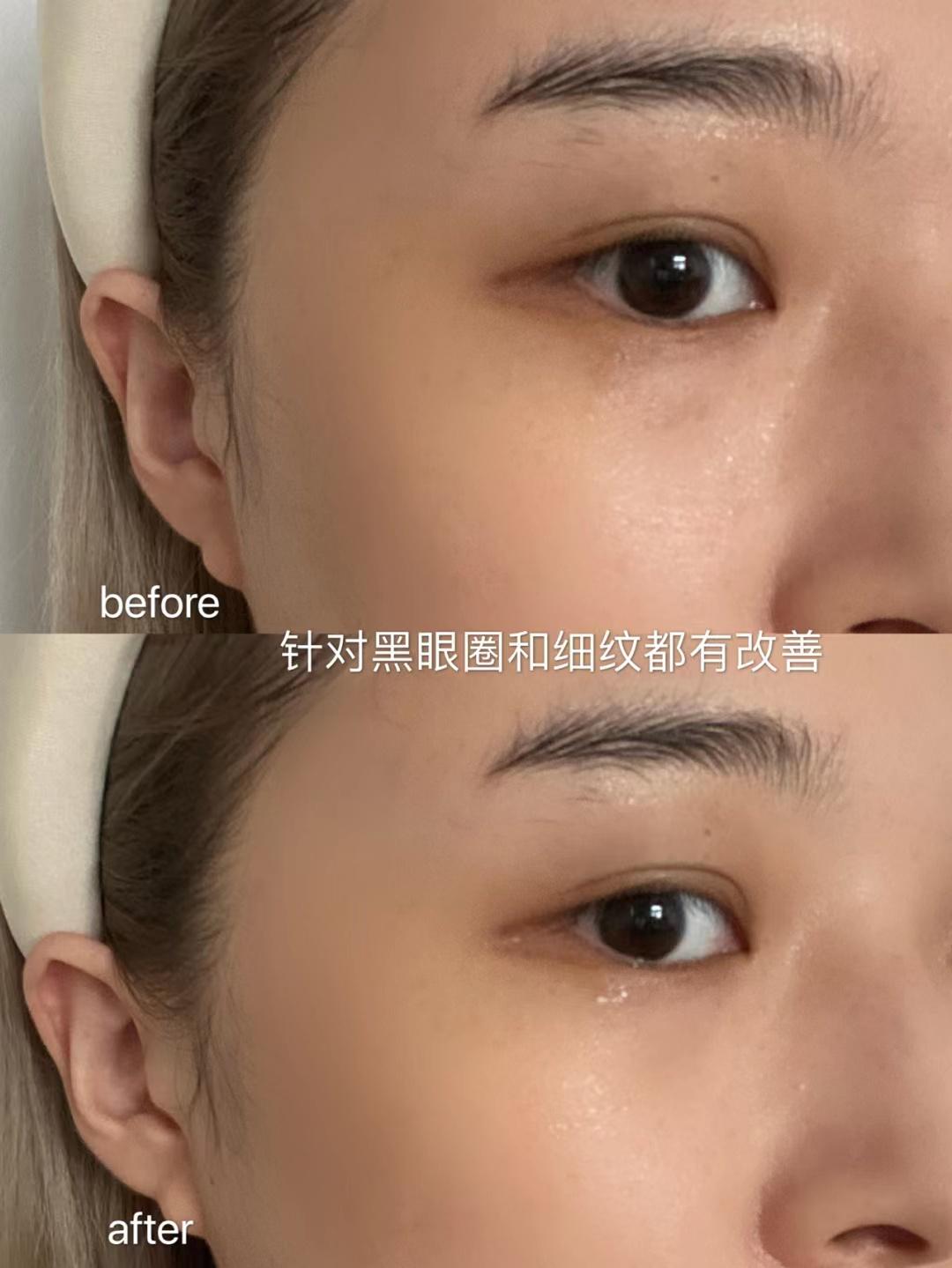 眼霜是大牌的好还是一般的好,普通眼霜跟功效型的眼霜的区别