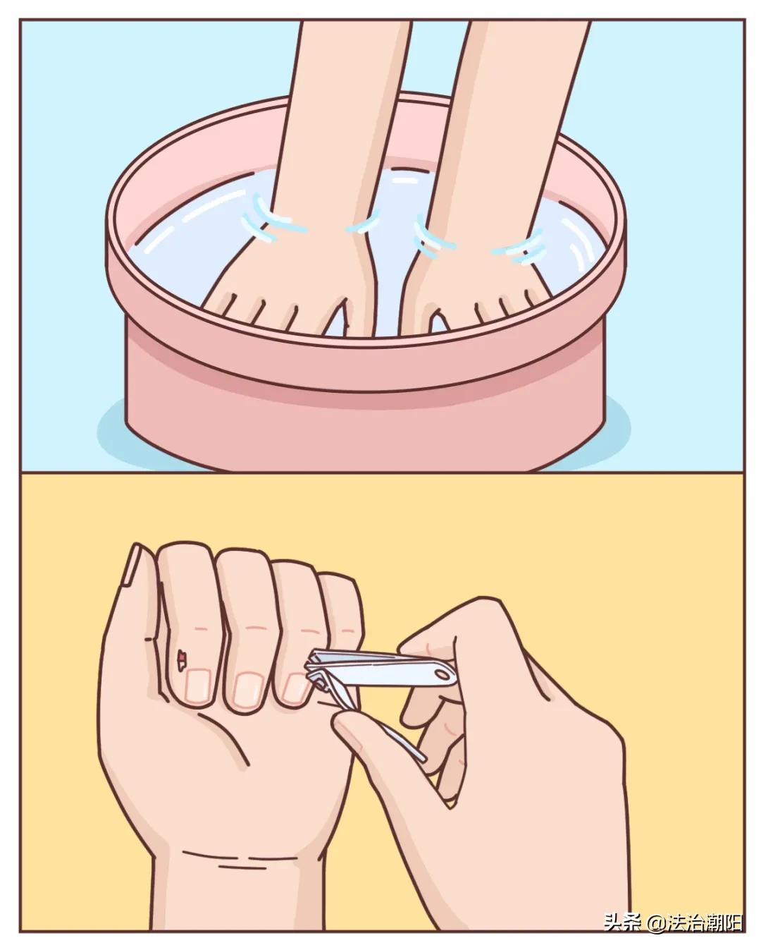 手指长倒刺缺乏哪种维生素,宝宝手指倒刺是缺什么维生素