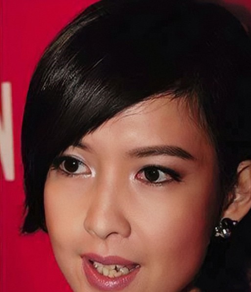 烤瓷牙的明星,烤瓷牙的明星都有谁