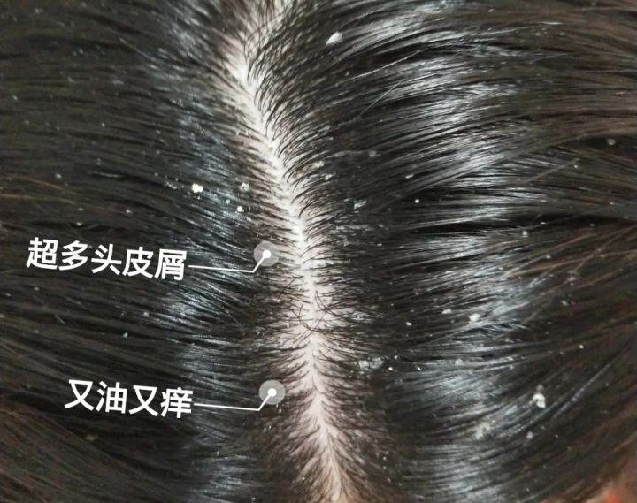 孕期清爽蓬松洗发水推荐,孕期洗发水需要选择孕妇专用吗