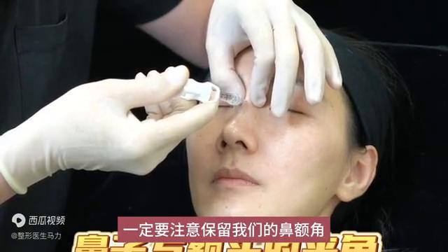 玻尿酸隆鼻填充山根,玻尿酸隆鼻怎么做听听专家的建议